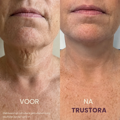 Trustora® | Second Skin Crème