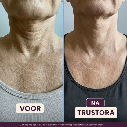 Trustora® | Second Skin Crème