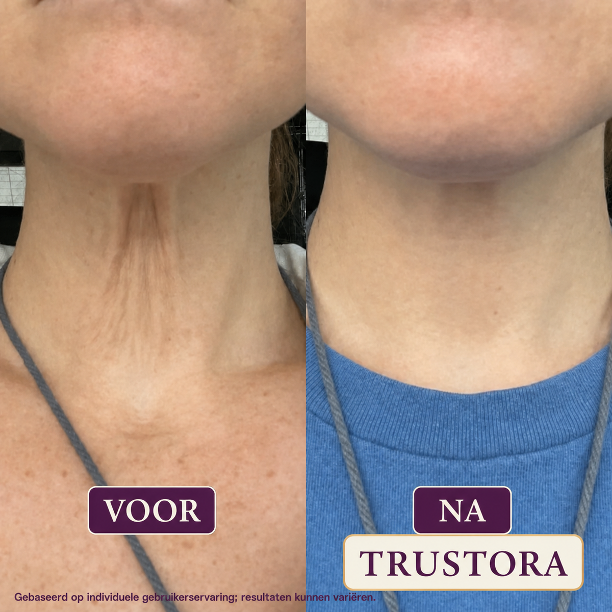 Trustora® | Second Skin Crème